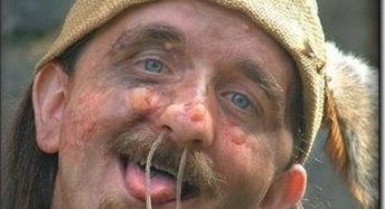 El hombre moco