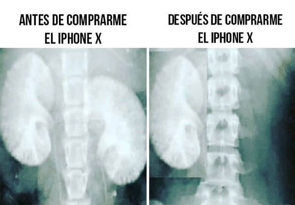 Antes y despues de comprar el Iphone X