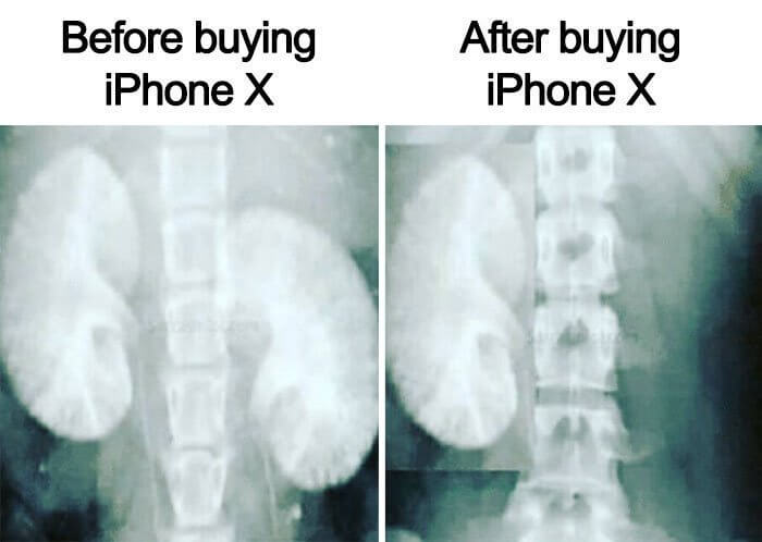 Antes y despues de comprar el nuevo Iphone